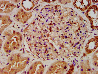 Immunohistochemistry (Formalin/PFA-fixed paraffin-embedded sections) - Anti-HYPE antibody (AB237521)