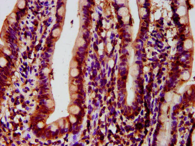 Immunohistochemistry (Formalin/PFA-fixed paraffin-embedded sections) - Anti-HYPE antibody (AB237521)