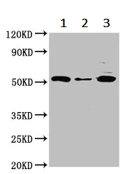 Western blot - Anti-HYPE antibody (AB237521)