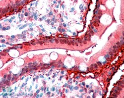 Immunohistochemistry (Formalin/PFA-fixed paraffin-embedded sections) - Anti-I-FABP antibody (AB60272)
