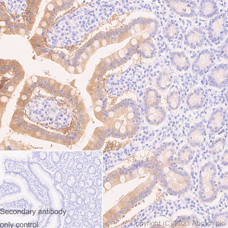 Immunohistochemistry (Formalin/PFA-fixed paraffin-embedded sections) - Anti-I-FABP antibody [EPR7136] (AB128860)