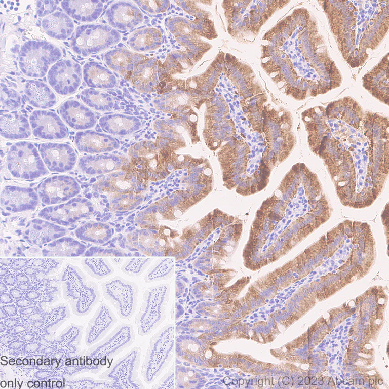 Immunohistochemistry (Formalin/PFA-fixed paraffin-embedded sections) - Anti-I-FABP antibody [EPR7136] (AB128860)
