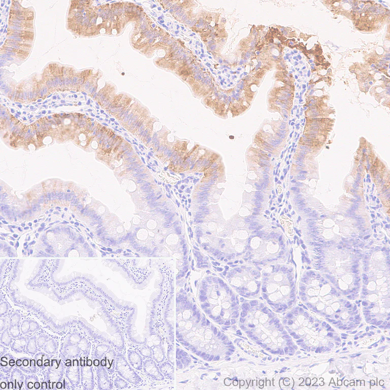 Immunohistochemistry (Formalin/PFA-fixed paraffin-embedded sections) - Anti-I-FABP antibody [EPR7136] - BSA and Azide free (AB248190)