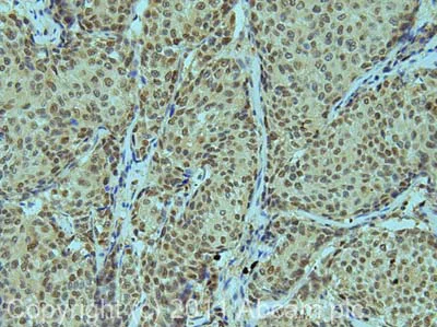 Immunohistochemistry (Formalin/PFA-fixed paraffin-embedded sections) - Anti-iASPP antibody (AB34898)