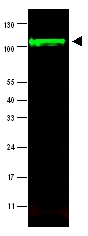 Western blot - Anti-iASPP antibody (AB34898)