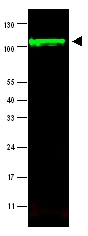 Western blot - Anti-iASPP antibody (AB34898)
