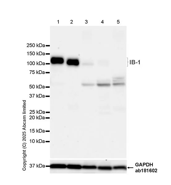 Western blot - Anti-IB-1 antibody [EPR30423-508] (AB325525)