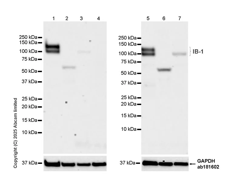 Western blot - Anti-IB-1 antibody [EPR30423-508] (AB325525)
