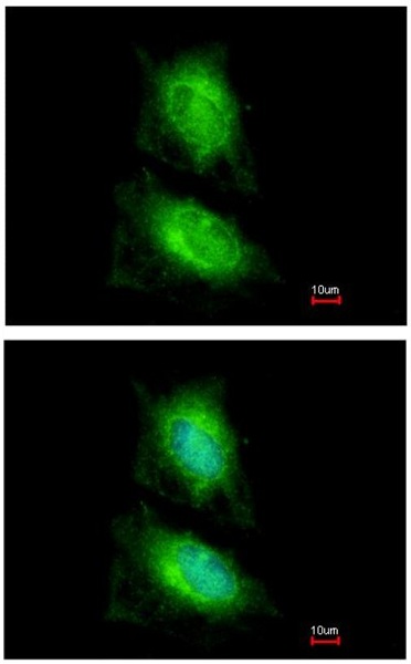 Immunocytochemistry/ Immunofluorescence - Anti-IB-2 antibody (AB154090), expandable thumbnail