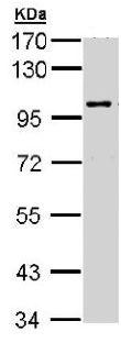 Western blot - Anti-IB-2 antibody (AB154090), expandable thumbnail