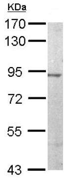 Western blot - Anti-IB-2 antibody (AB154090), expandable thumbnail