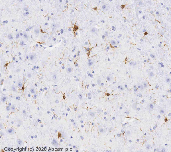 Immunohistochemistry (Formalin/PFA-fixed paraffin-embedded sections) - Anti-Iba1 antibody (AB107159), expandable thumbnail
