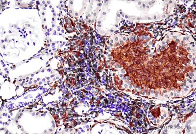 Immunohistochemistry (Formalin/PFA-fixed paraffin-embedded sections) - Anti-Iba1 antibody (AB107159), expandable thumbnail