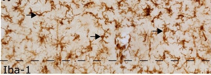 Immunohistochemistry (Formalin/PFA-fixed paraffin-embedded sections) - Anti-Iba1 antibody (AB5076), expandable thumbnail
