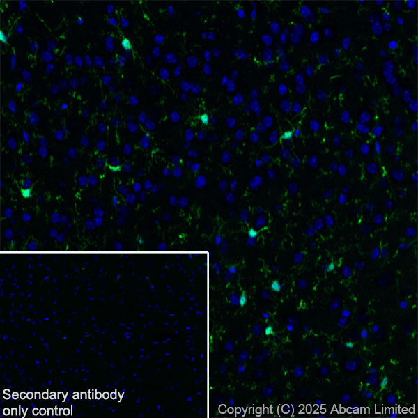 Immunohistochemistry (Frozen sections) - Anti-Iba1 antibody [EPR16588] (ab178846), expandable thumbnail