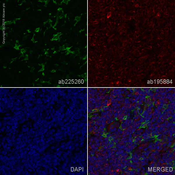 Immunohistochemistry (Formalin/PFA-fixed paraffin-embedded sections) - Anti-Iba1 antibody [EPR16588] - BSA and Azide free (AB220815)