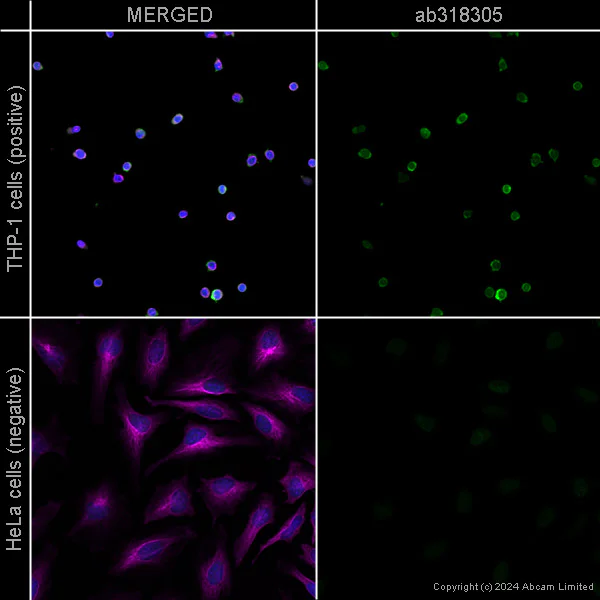 Immunocytochemistry/ Immunofluorescence - Anti-Iba1 antibody [EPR16588] – Chicken IgY (Chimeric) – BSA and Azide Free (AB318305)