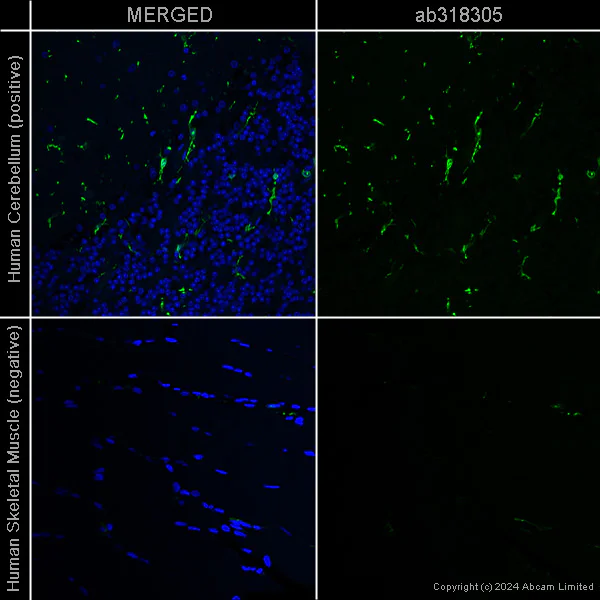 Immunohistochemistry (Formalin/PFA-fixed paraffin-embedded sections) - Anti-Iba1 antibody [EPR16588] – Chicken IgY (Chimeric) – BSA and Azide Free (AB318305)