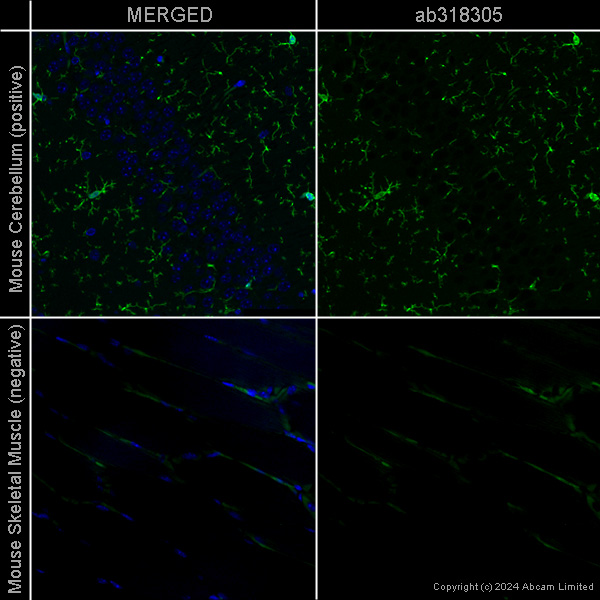 Immunohistochemistry (Formalin/PFA-fixed paraffin-embedded sections) - Anti-Iba1 antibody [EPR16588] – Chicken IgY (Chimeric) – BSA and Azide Free (AB318305), expandable thumbnail