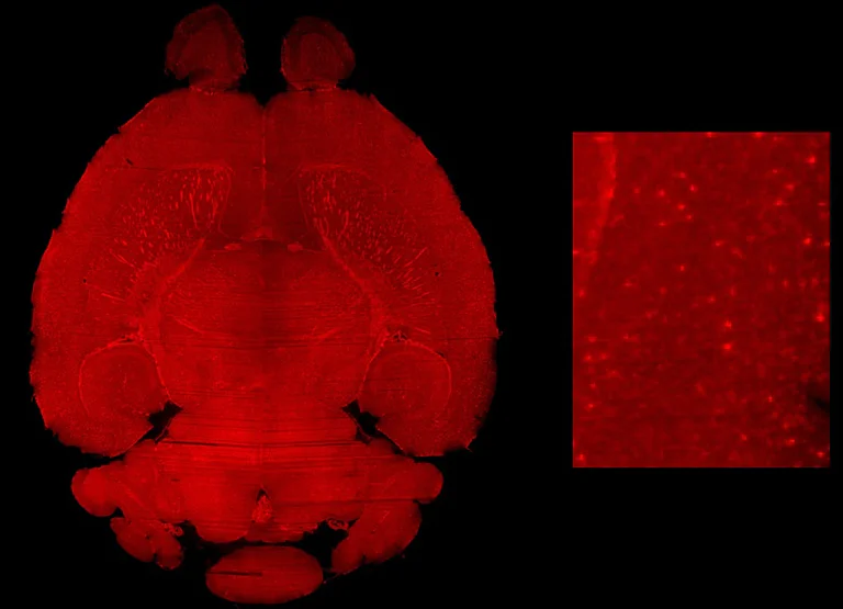 IHC-tissue clearing - Anti-Iba1 antibody [EPR16588] - Microglia marker (AB178846)