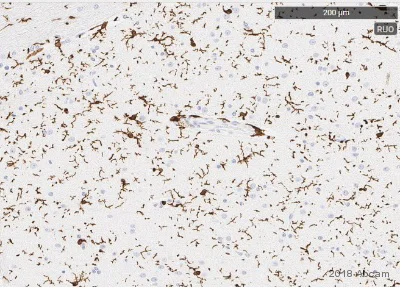 Immunohistochemistry (Formalin/PFA-fixed paraffin-embedded sections) - Anti-Iba1 antibody [EPR16588] - Microglia marker (AB178846)