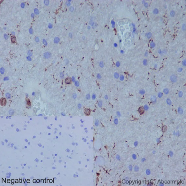 Immunohistochemistry (Formalin/PFA-fixed paraffin-embedded sections) - Anti-Iba1 antibody [EPR16588] - Microglia marker (AB178846)
