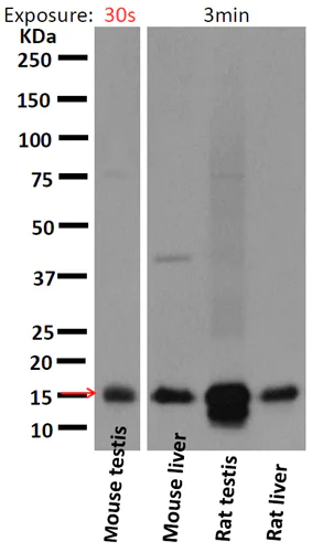 Western blot - Anti-Iba1 antibody [EPR16588] - Microglia marker (AB178846)