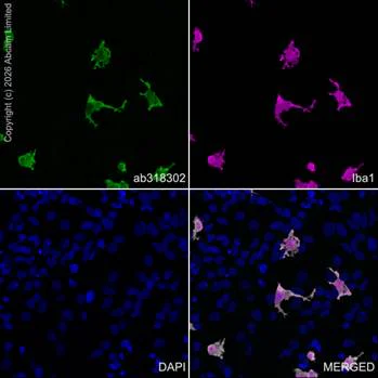 Immunocytochemistry/ Immunofluorescence - Anti-Iba1 antibody [EPR16588] - Microglia marker – Chicken IgY (Chimeric) (AB318302)
