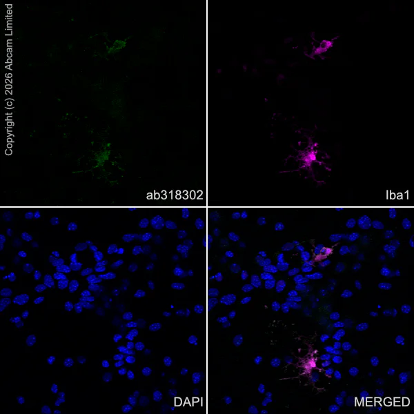 Immunocytochemistry/ Immunofluorescence - Anti-Iba1 antibody [EPR16588] - Microglia marker – Chicken IgY (Chimeric) (AB318302)