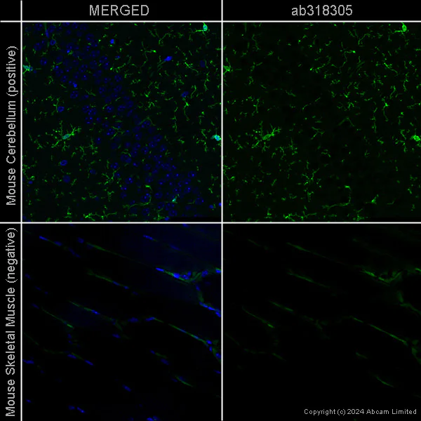 Immunohistochemistry (Formalin/PFA-fixed paraffin-embedded sections) - Anti-Iba1 antibody [EPR16588] - Microglia marker – Chicken IgY (Chimeric) (AB318302)