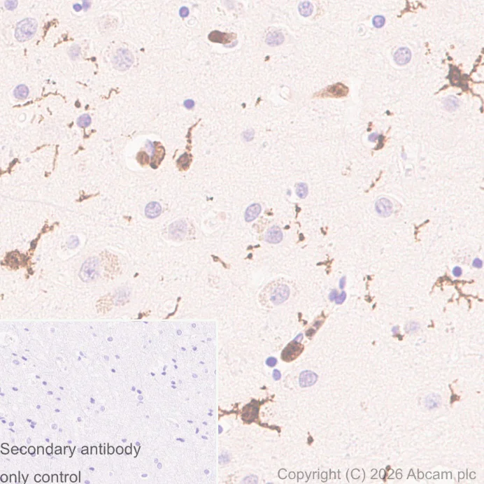 Immunohistochemistry (Formalin/PFA-fixed paraffin-embedded sections) - Anti-Iba1 antibody [EPR16588] - Microglia marker – Chicken IgY (Chimeric) (AB318302)
