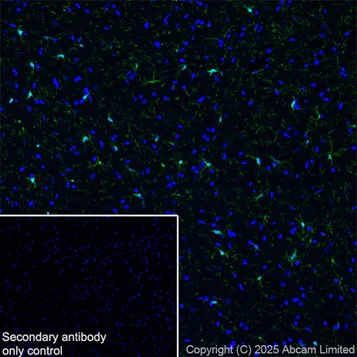 Immunohistochemistry (Frozen sections) - Anti-Iba1 antibody [EPR16588] - Microglia marker – Chicken IgY (Chimeric) (AB318302)