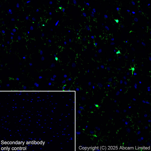Immunohistochemistry (Frozen sections) - Anti-Iba1 antibody [EPR16589] (ab178847), expandable thumbnail
