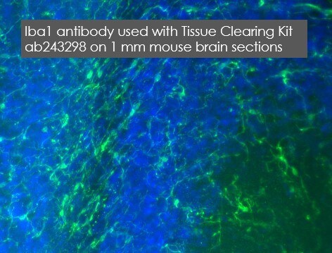 Immunohistochemistry (PFA fixed) - Anti-Iba1 antibody [EPR16589] - BSA and Azide free (AB221790), expandable thumbnail