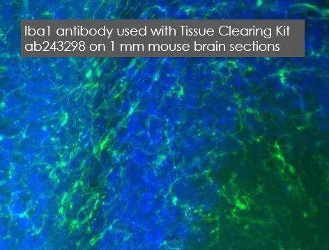 Immunohistochemistry (PFA fixed) - Anti-Iba1 antibody [EPR16589] - BSA and Azide free (AB221790)