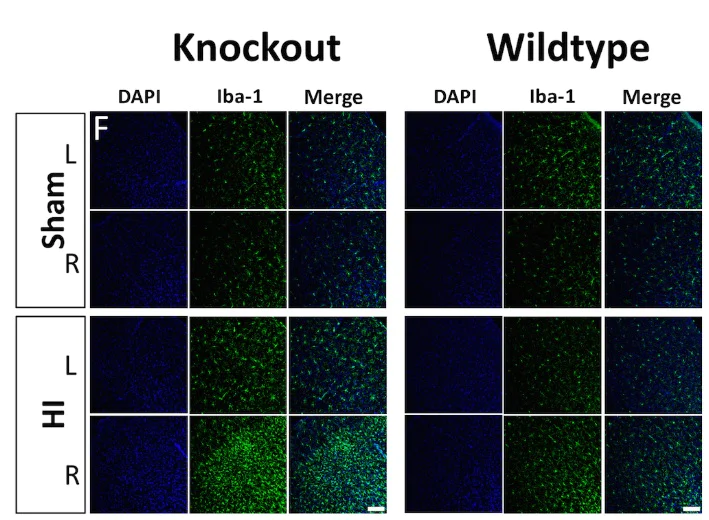 Immunohistochemistry (Formalin/PFA-fixed paraffin-embedded sections) - Anti-Iba1 antibody [EPR16589] - Microglia marker (AB178847)