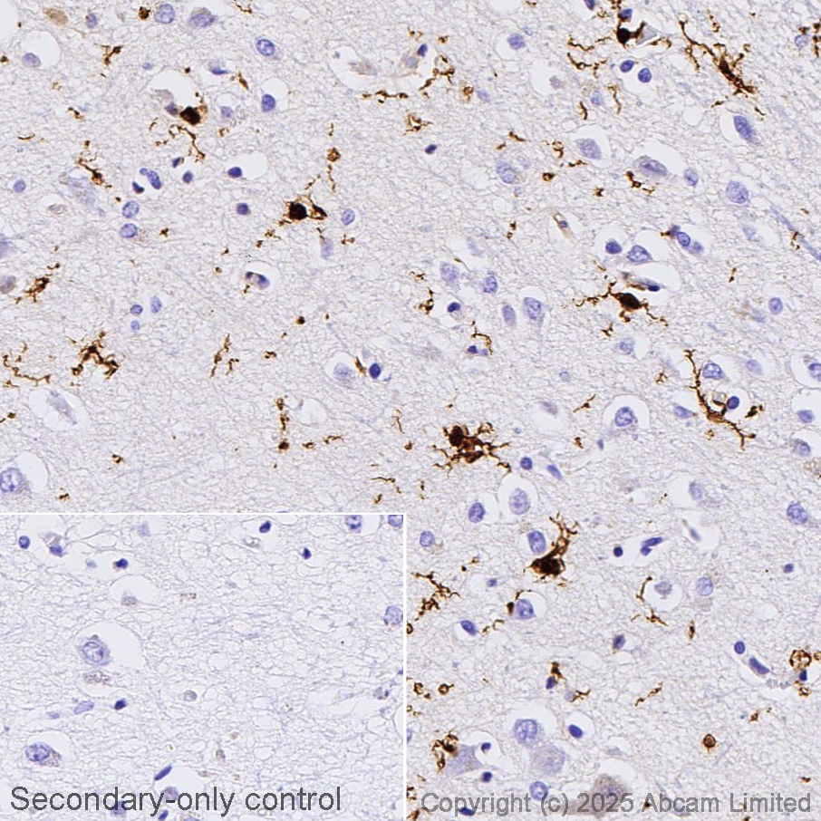 Anti-Iba1 antibody [EPR16589] Rabbit monoclonal (ab178847) | Abcam