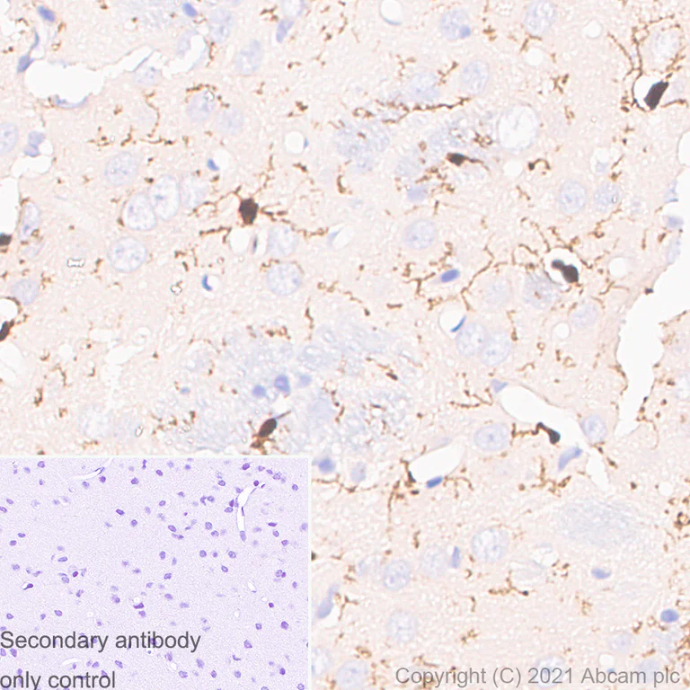 Immunohistochemistry (Formalin/PFA-fixed paraffin-embedded sections) - Anti-Iba1 antibody [EPR16589] - Microglia marker - Mouse IgG1 (Chimeric) (AB283319)