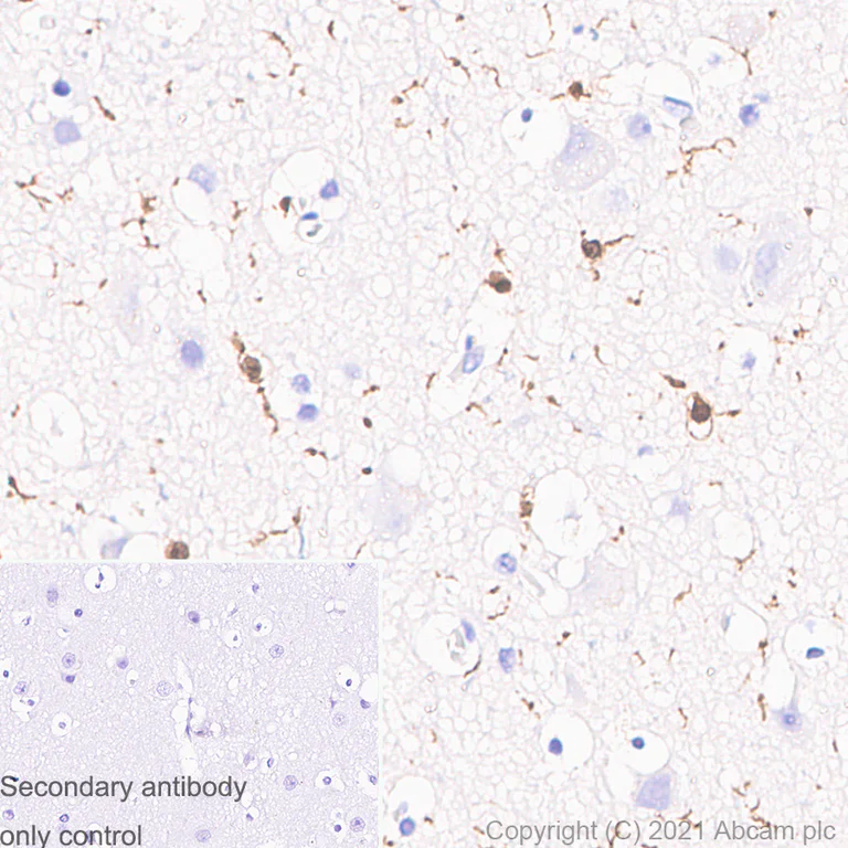 Immunohistochemistry (Formalin/PFA-fixed paraffin-embedded sections) - Anti-Iba1 antibody [EPR16589] - Microglia marker - Rat IgG2a (Chimeric) (AB283346)