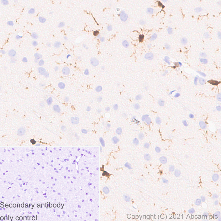 その他 user_90a2cfc9 Anti-Iba1 antibody [EPR16589]. Rat Monoclonal (ab283346) | Abcam