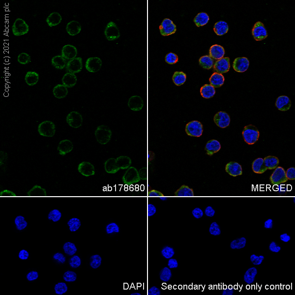 Immunocytochemistry/ Immunofluorescence - Anti-Iba1 antibody [EPR6136(2)] (AB178680), expandable thumbnail