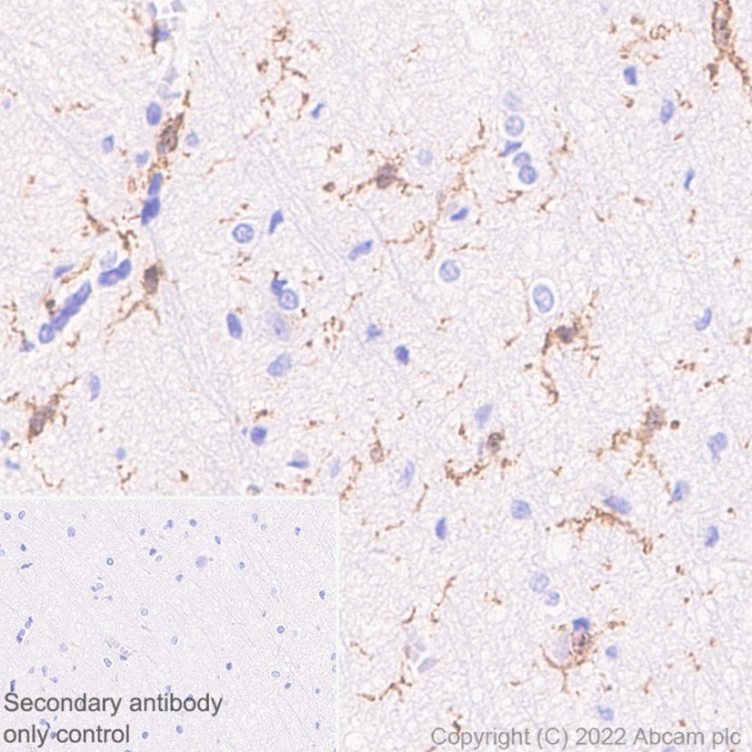 Immunohistochemistry (Formalin/PFA-fixed paraffin-embedded sections) - Anti-Iba1 antibody [EPR6136(2)] (ab178680), expandable thumbnail