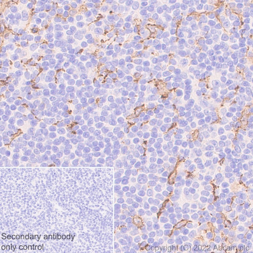 Immunohistochemistry (Formalin/PFA-fixed paraffin-embedded sections) - Anti-Iba1 antibody [EPR6136(2)] (ab178680), expandable thumbnail