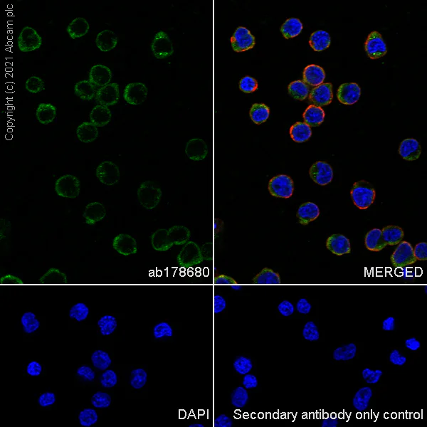 Immunocytochemistry/ Immunofluorescence - Anti-Iba1 antibody [EPR6136(2)] - Microglia marker (AB178680)