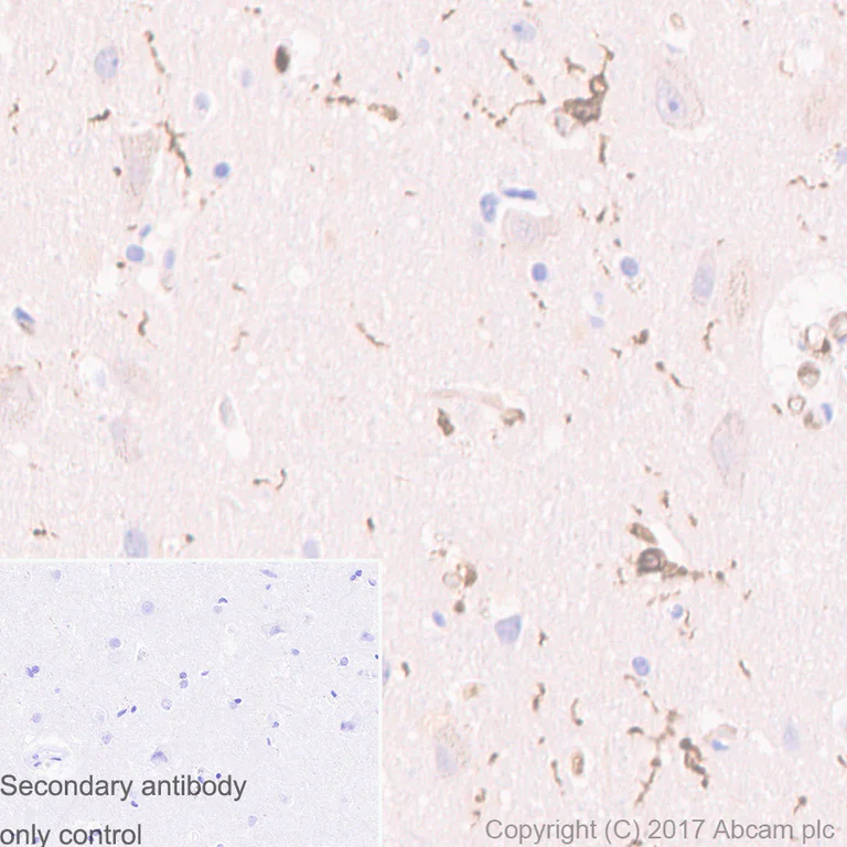 Immunohistochemistry (Formalin/PFA-fixed paraffin-embedded sections) - Anti-Iba1 antibody [EPR6136(2)] - Microglia marker (AB178680)
