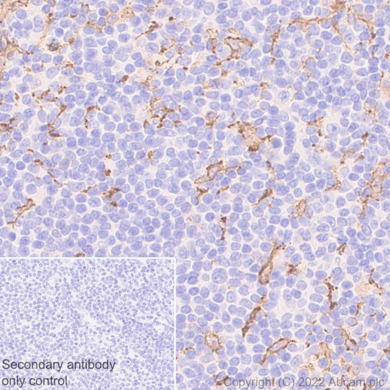 Immunohistochemistry (Formalin/PFA-fixed paraffin-embedded sections) - Anti-Iba1 antibody [EPR6136(2)] - Microglia marker (AB178680)