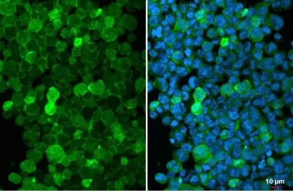 Immunocytochemistry/ Immunofluorescence - Anti-Iba1 antibody [HL22] - BSA and Azide free (AB289370)