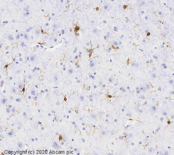 Immunohistochemistry (Formalin/PFA-fixed paraffin-embedded sections) - Anti-Iba1 antibody - Microglia marker (AB107159)
