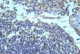 Immunohistochemistry (Formalin/PFA-fixed paraffin-embedded sections) - Anti-Iba1 antibody - Microglia marker (AB108539)