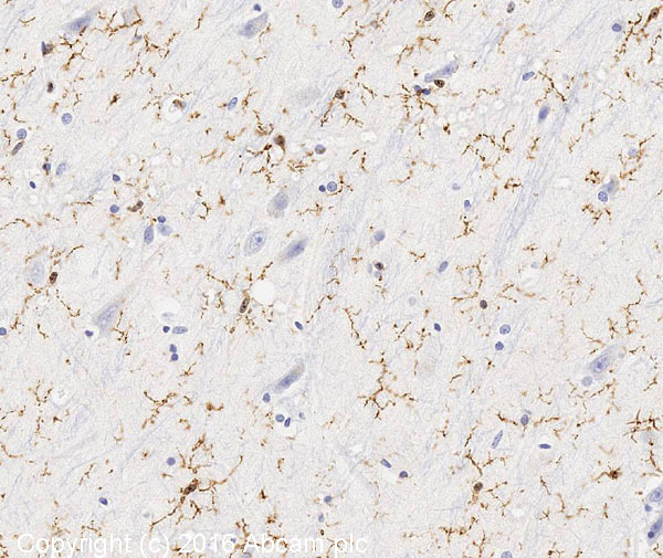 Immunohistochemistry (Formalin/PFA-fixed paraffin-embedded sections) - Anti-Iba1 antibody - Microglia marker (AB108539)